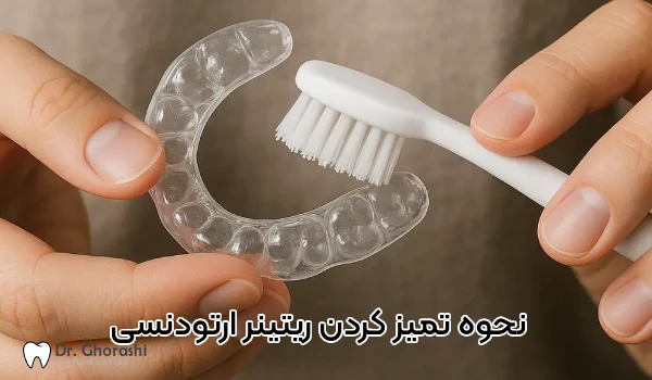 نحوه تمیز کردن ریتینر ارتودنسی