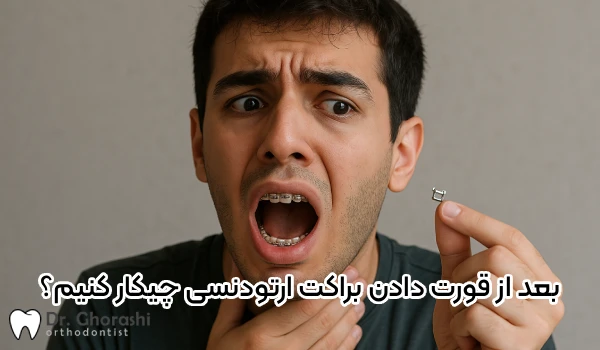 بعد از بلعیدن براکت ارتودنسی چکار کنیم؟