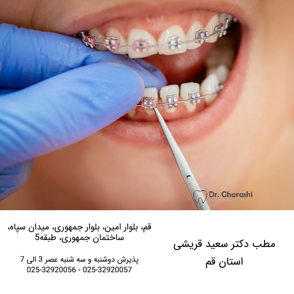 بهترین متخصص ارتودنسی در قم
