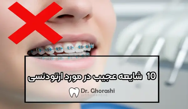 10 شایعه عجیب درباره ارتودنسی دندان