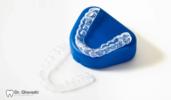 روش تمیز کردن ریتینر ارتودنسی